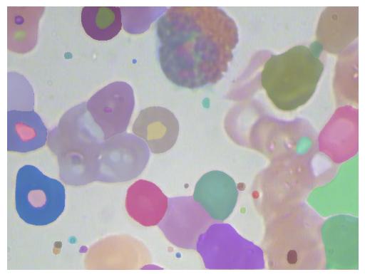 Using SAM to segment blood cells in cell micorscopy images.